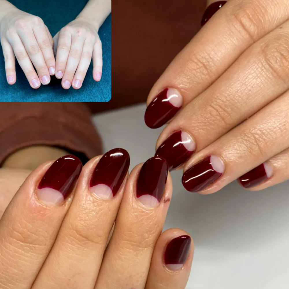 Nailz™ - Stylo de Croissance des Ongles