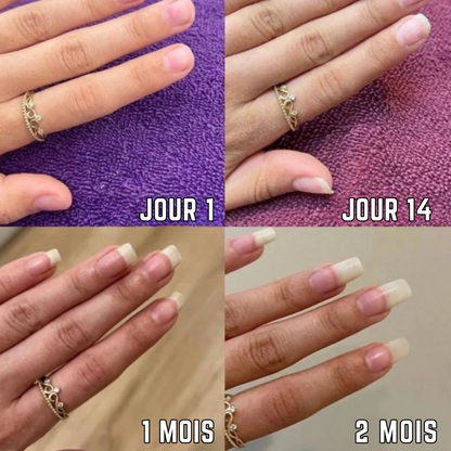 Nailz™ - Stylo de Croissance des Ongles