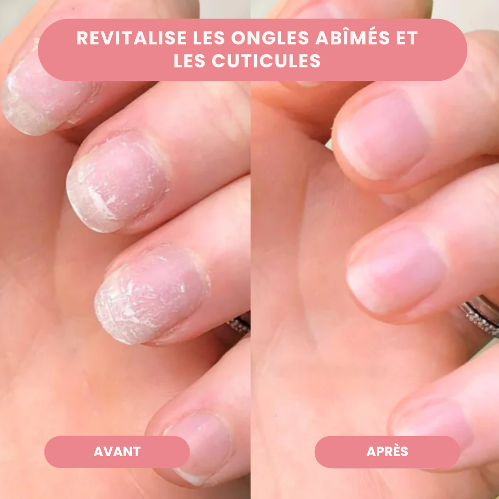 Nailz™ - Stylo de Croissance des Ongles