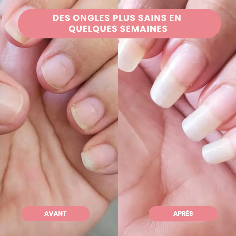 Nailz™ - Stylo de Croissance des Ongles