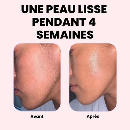 EpilSmooth™ - Épilation rapide du visage